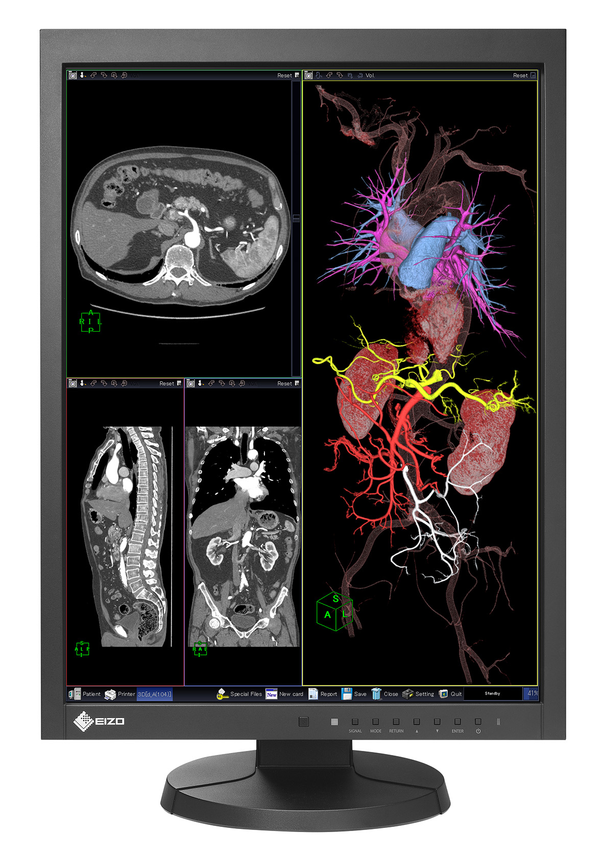 EIZO RadiForce MX215, EIZO Europe GmbH, Story - PresseBox